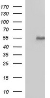 MMP13 Antibody