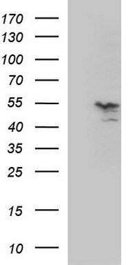 MMP13 Antibody