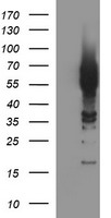 Tyrosine Hydroxylase Antibody