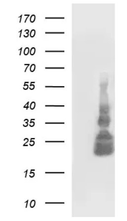TNF alpha Antibody