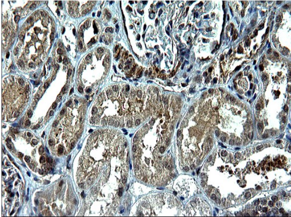 TNF alpha Antibody