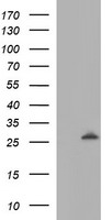 Galectin 3 Antibody