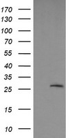 Galectin 3 Antibody