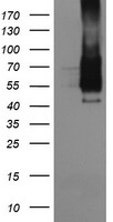 CD64 Antibody