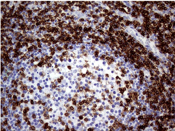 CD3E Antibody