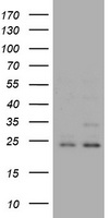 RAB21 Antibody