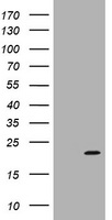 ARPC5 Antibody