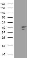 DCPS Antibody