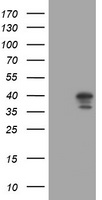 DCPS Antibody