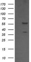 CESK1 Antibody