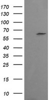 CESK1 Antibody