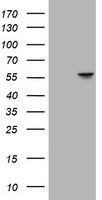 ATP6V1B2 Antibody