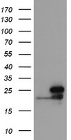 NDUFB10 Antibody