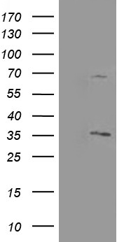 PLPBP Antibody