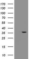 RFC2 Antibody