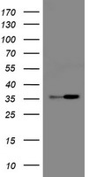 RFC2 Antibody