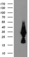 MMACHC Antibody