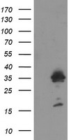 MMACHC Antibody