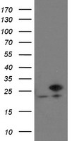 PFDN3 Antibody