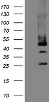 Mannose Phosphate Isomerase Antibody