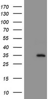 NQO2 Antibody