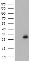 NQO2 Antibody