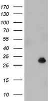 NQO2 Antibody