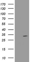NANP Antibody
