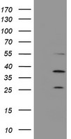 Proteasome 20S beta 7 Antibody