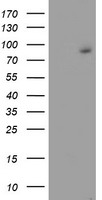 FBXO21 Antibody