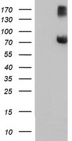 FBXO21 Antibody