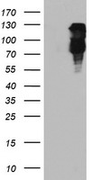 FBXO21 Antibody