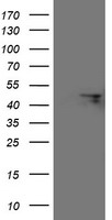 FBXO31 Antibody
