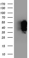 TRK fused gene Antibody