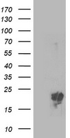 PMVK Antibody