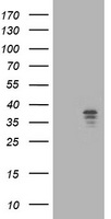 NUDT9 Antibody