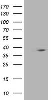 HSPBP1 Antibody