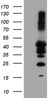 PTP1B Antibody