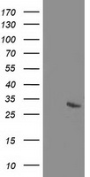 RGS5 Antibody