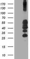 PTP1B Antibody