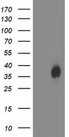 HDHD2 Antibody