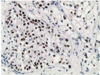 TP53 Antibody