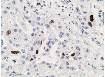 TP53 Antibody