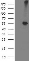 ADH1B Antibody