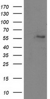 ATP6V1B1 Antibody