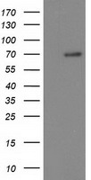 Beta TRCP Antibody