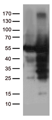 Catalase Antibody