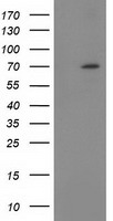 Beta TRCP Antibody