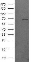 Beta TRCP Antibody