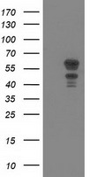 KATNAL1 Antibody